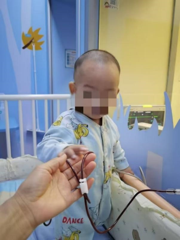 舒戴综合征 脐带血移植 稀有病治疗_中国脐带血库