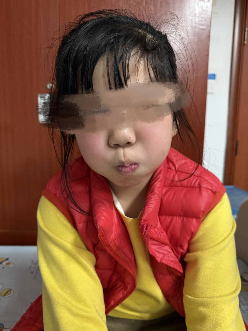 嘴角歪斜,眼睛无法闭合!江西家长千万警惕