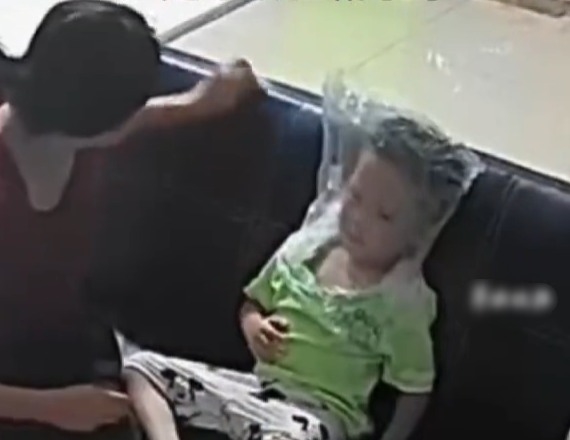 男孩很难呼吸，母亲正在用塑料袋遮住头部以供