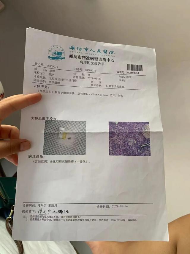 周辉宫颈癌诊断报告
