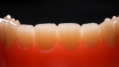 多材料一体打印活动义齿