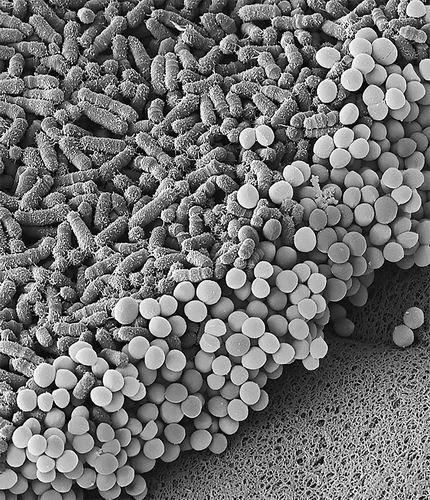 人类肠道微生物使癌症治疗更有效