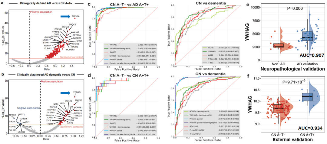 复旦大学研发新型早筛早诊检测试剂，突破性提前 15 年预测阿尔茨海默病发病风险