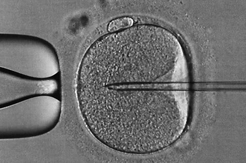 图片来源：Phanie/Science Photo Library