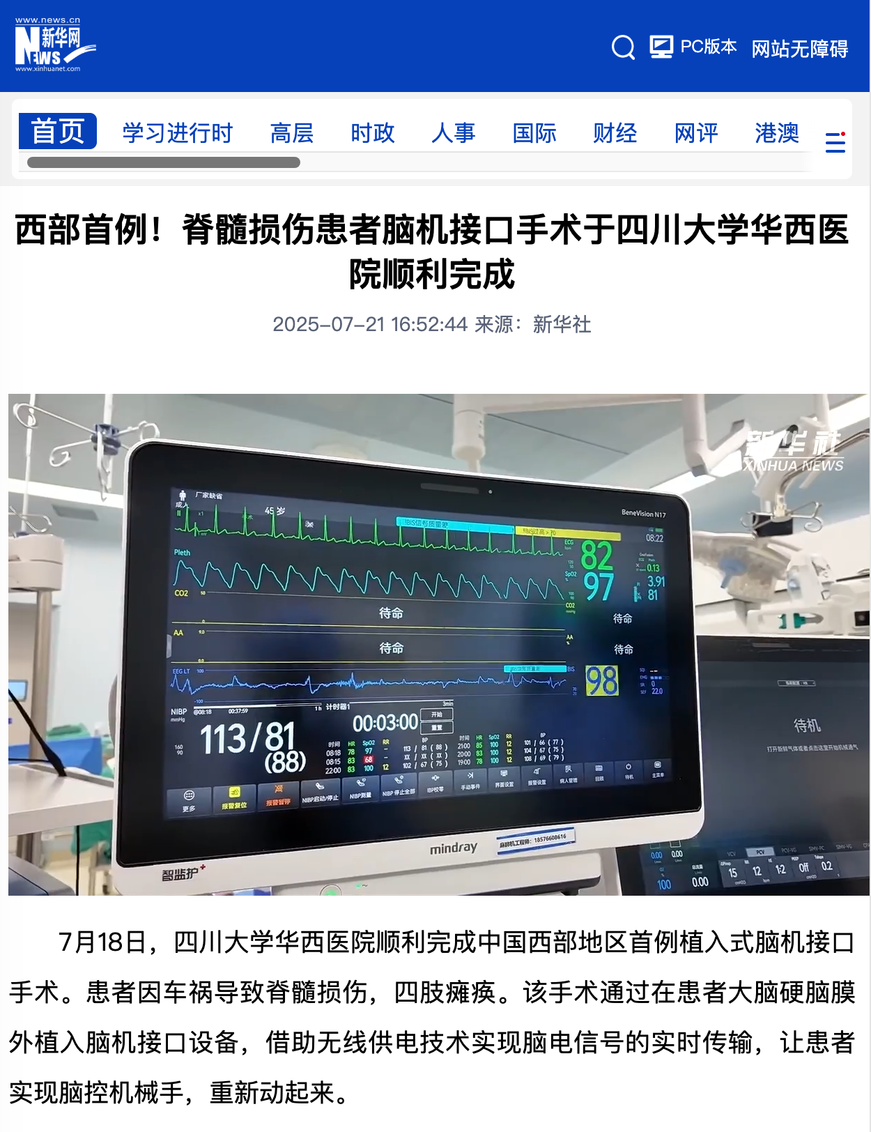 西部首例：四川大学华西医院顺利完成脊髓损伤患者脑机接口手术，可脑控机械手