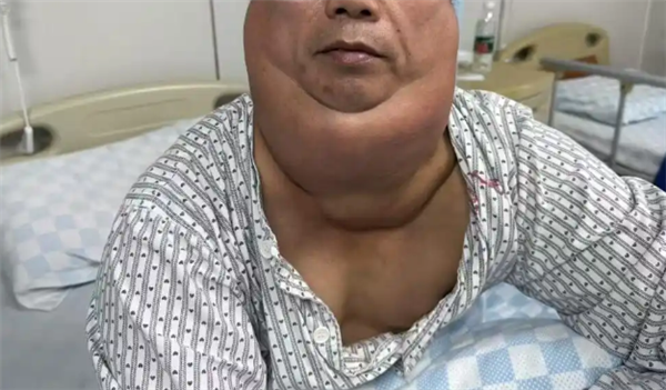 ÿһѾԻá˹ӡҽʱȾƺҪС֬