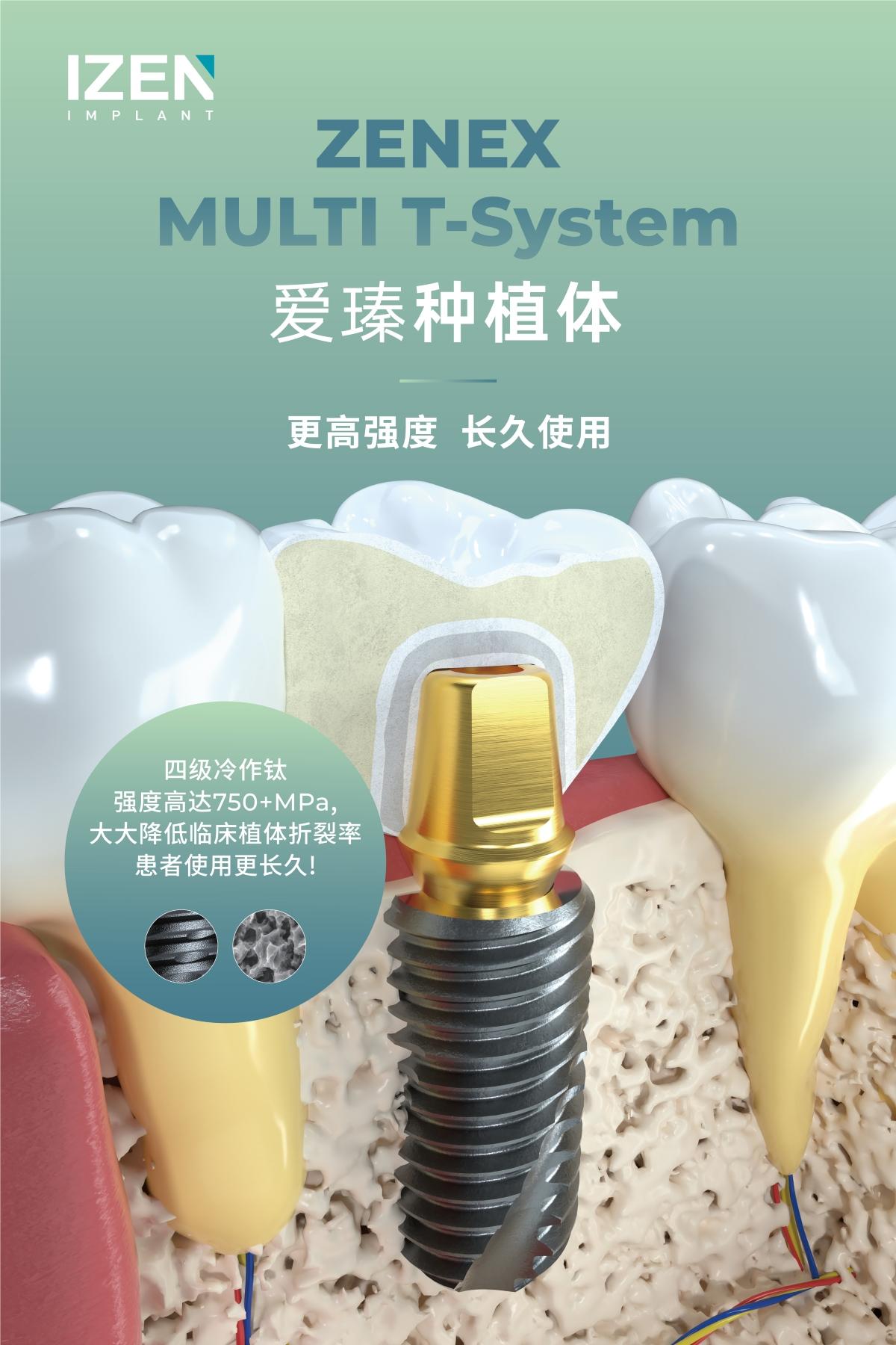 爱瑧IZEN 种植体加速布局中国市场，助力口腔事业发展