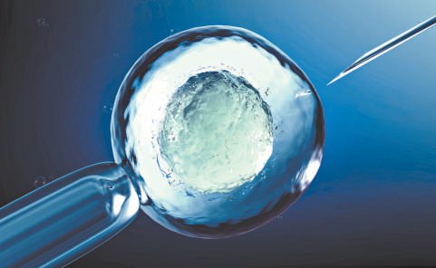 体外受精示意图