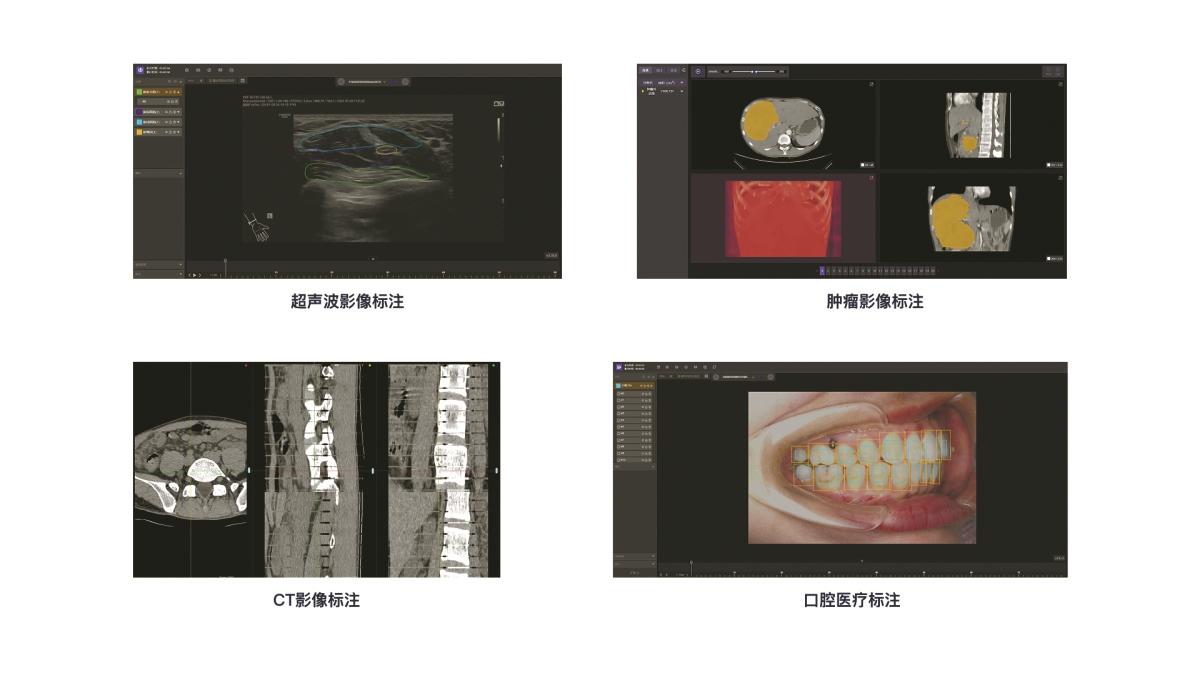 博登标注的医疗影像数据。