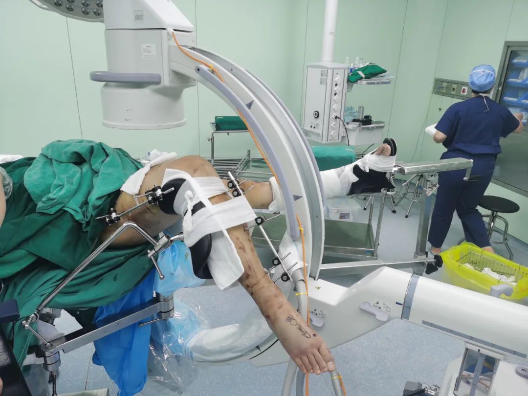 外卖员遭车祸受重伤,多学科通力合作跑赢"死神"