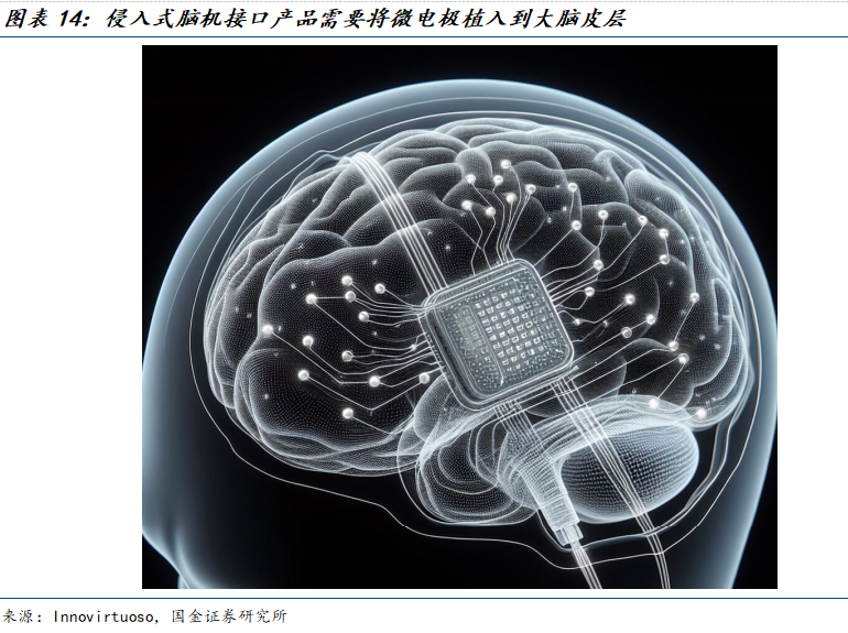 麦澜德非侵入式脑机接口商业化提速 多场景落地引62家机构关注