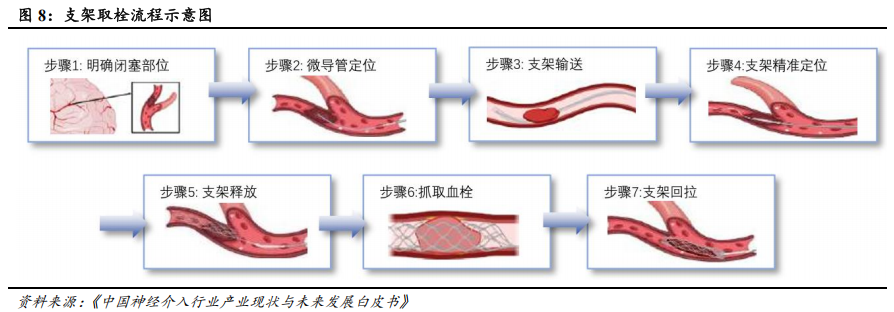 器械包括什么医疗器械行业深度：神经介入行业，大空间，新机遇_https://www.jmylbn.com_新闻资讯_第6张