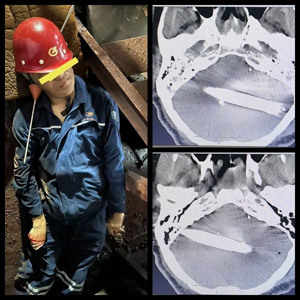 图源：中南大学湘雅三医院