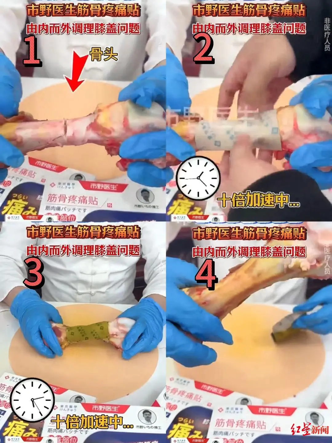　　▲网传接骨视频截图