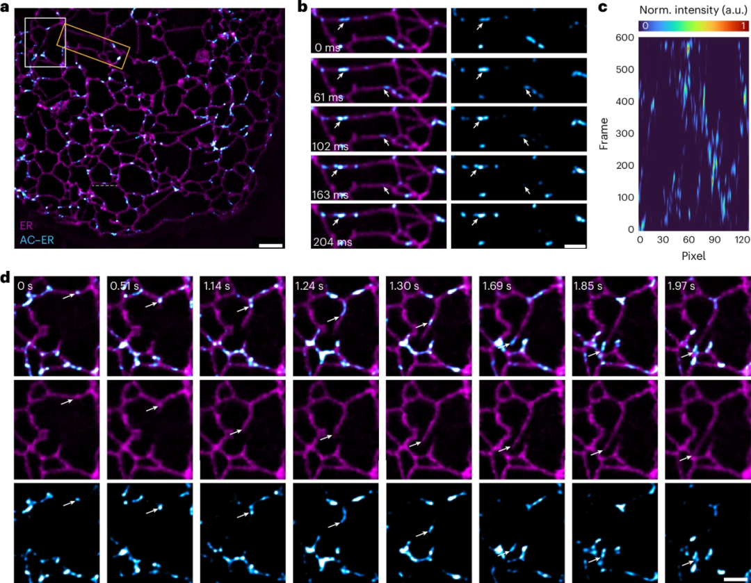 图丨毫秒尺度下内质网相关肌动蛋白动态的超分辨成像。（来源：Nature Photonics）