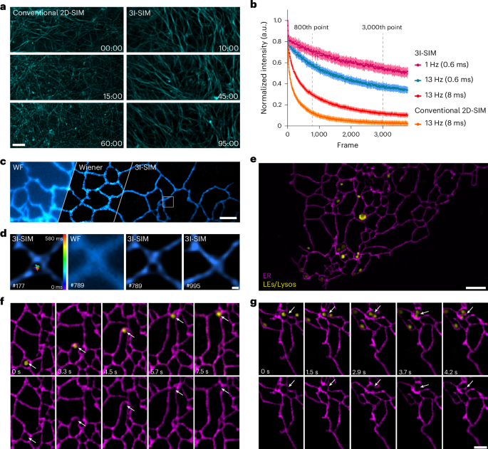 图丨3I-SIM 实现快速且温和的活细胞细胞器成像（来源：Nature Photonics）