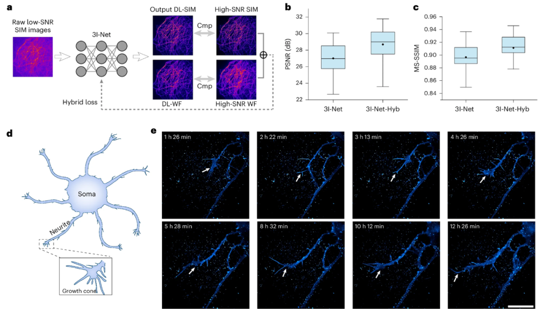 图丨深度学习提升了 3I-SIM 在光子受限条件下的成像能力（来源：Nature Photonics）