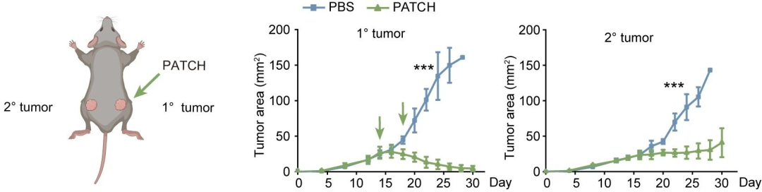 ▲ PATCH 疗法激发系统性免疫的效果图