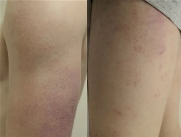 图 2. 典型鸡皮肤（来自参考资料）