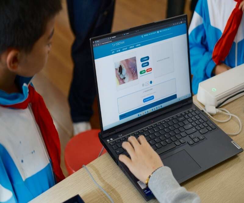 “AI牙慧诊”系统实时快速检测界面