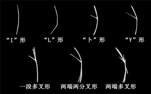 △ 各种形状的肌间刺