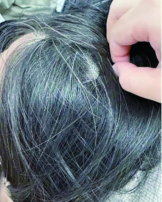 受访者出现许多白发 受访者供图