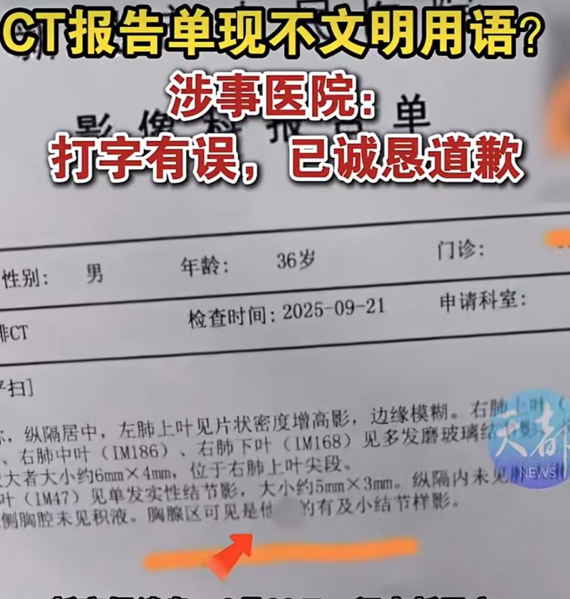 ▲“CT报告现脏话”之类的低级错误，需想办法避免。图/天都新闻视频截图