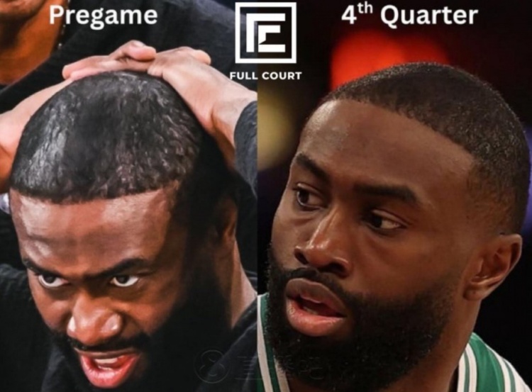 巴克利“建议”杰伦-布朗：当我开始秃头时 我立马就决定剃光！