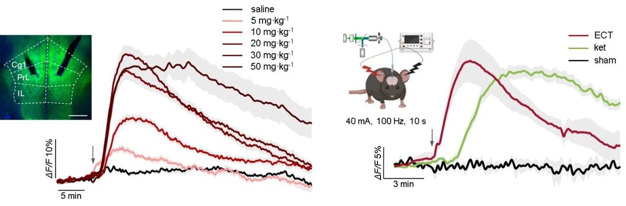 ▲ 图 1. 氯胺酮（Ketamine）和电休克疗法（ECT）诱导内侧前额叶皮层腺苷激增