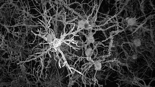 科学家发现可抑制老年痴呆的脑细胞