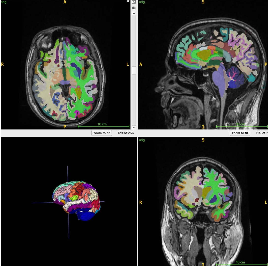 ▲ 图源：Cyrus Raji 博士