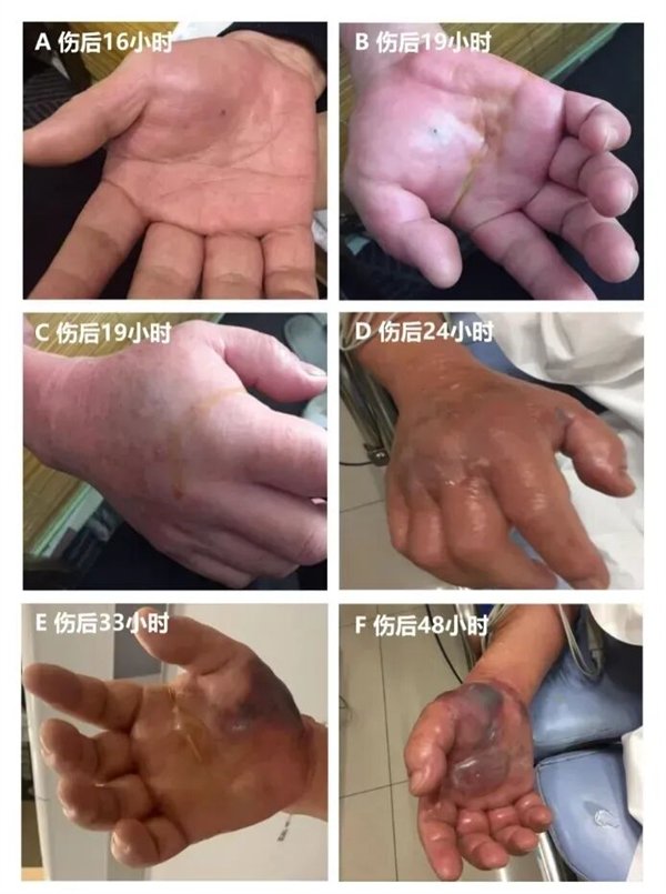 图片来源于《中华急诊医学杂志》