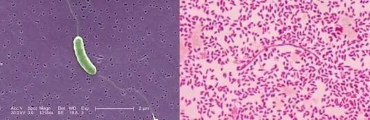 镜下的创伤弧菌 图源网络