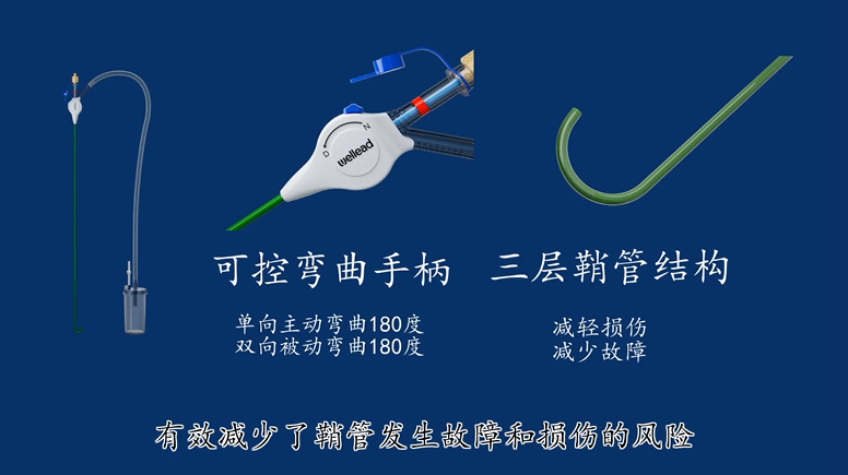 输尿管鞘是什么可控弯曲输尿管鞘导管及附件_https://www.jmylbn.com_新闻资讯_第3张