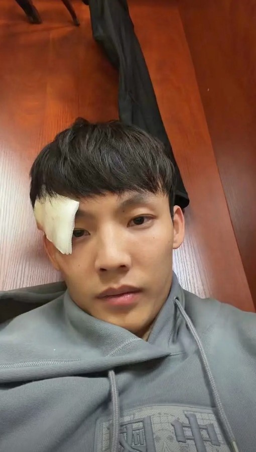 眉骨缝了3针！徐杰晒照：新赛季 为广东而战 兄弟齐心 开门红