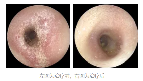 图源：作者提供的门诊病例