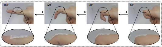 新型敷料在常温时可以与关节处保持紧密贴合 图片来源：北科科研