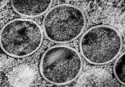 图片来源：NIAID/SPL