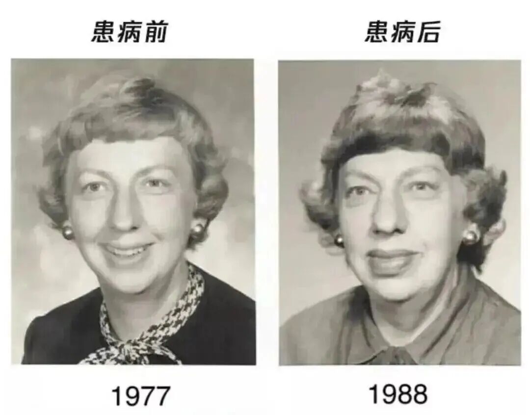 △图源：《临床内分泌图谱：神经内分泌与垂体疾病》