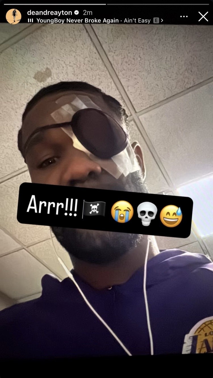 明日洛杉矶德比 艾顿可以出战！里夫斯与蒂耶罗继续缺席