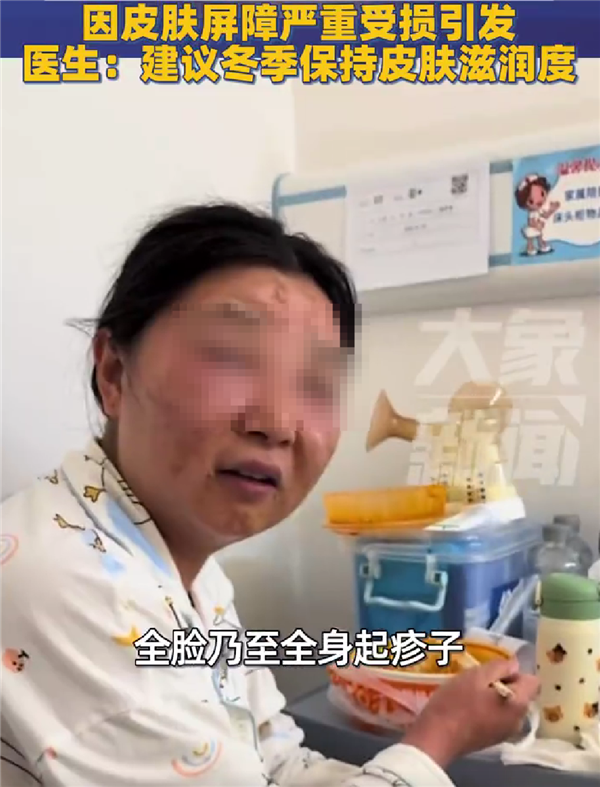 怕孩子被传染流感：新手宝妈频繁洗手致过敏、脸变形