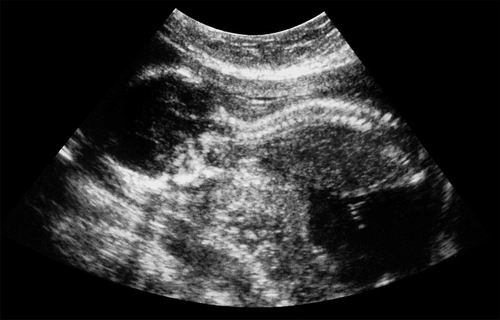 图片来源：Fraser/Science Photo Library