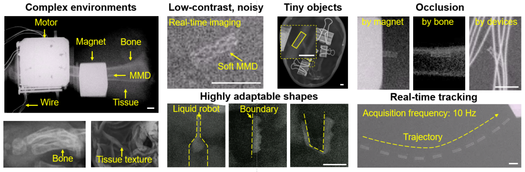 X光下微型医疗器械的检测挑战