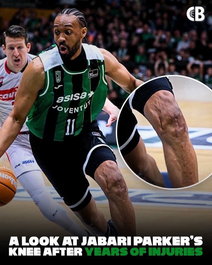 贾巴里·帕克膝盖近照：沟壑纵横 千疮百孔！曾遭两次ACL撕裂