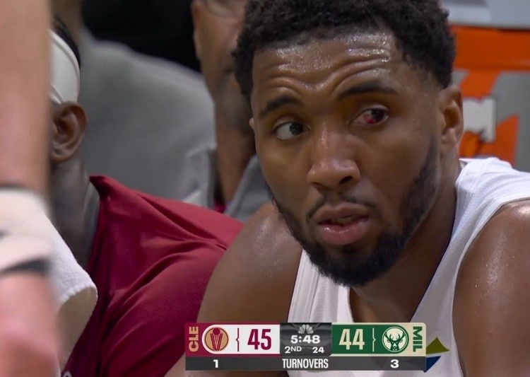 米切尔：我的左眼几乎看不见 得分能力不行想在其他方面帮助球队