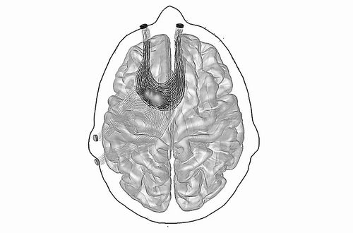 图片来源：ERIN SCHAEFFER