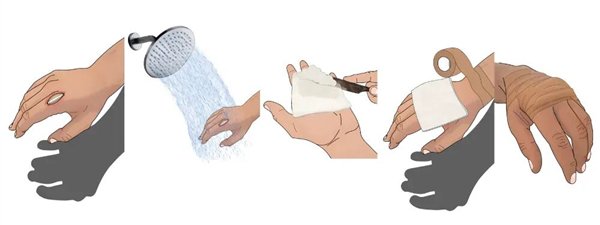 图3. 家庭伤口护理流程示意图（整理自参考资料）