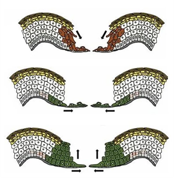 图1. 伤口再上皮化的示意图：箭头显示的是上皮生长的方向（来自参考资料）