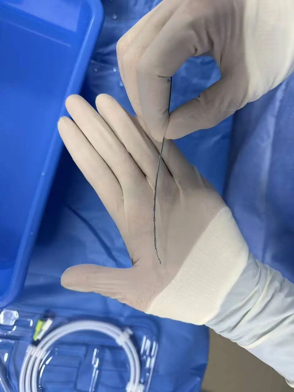 在脑机接口神经调控手术中，医生在吴女士体内植入“脊髓神经刺激测试电极”。（大冶市中医医院供图）