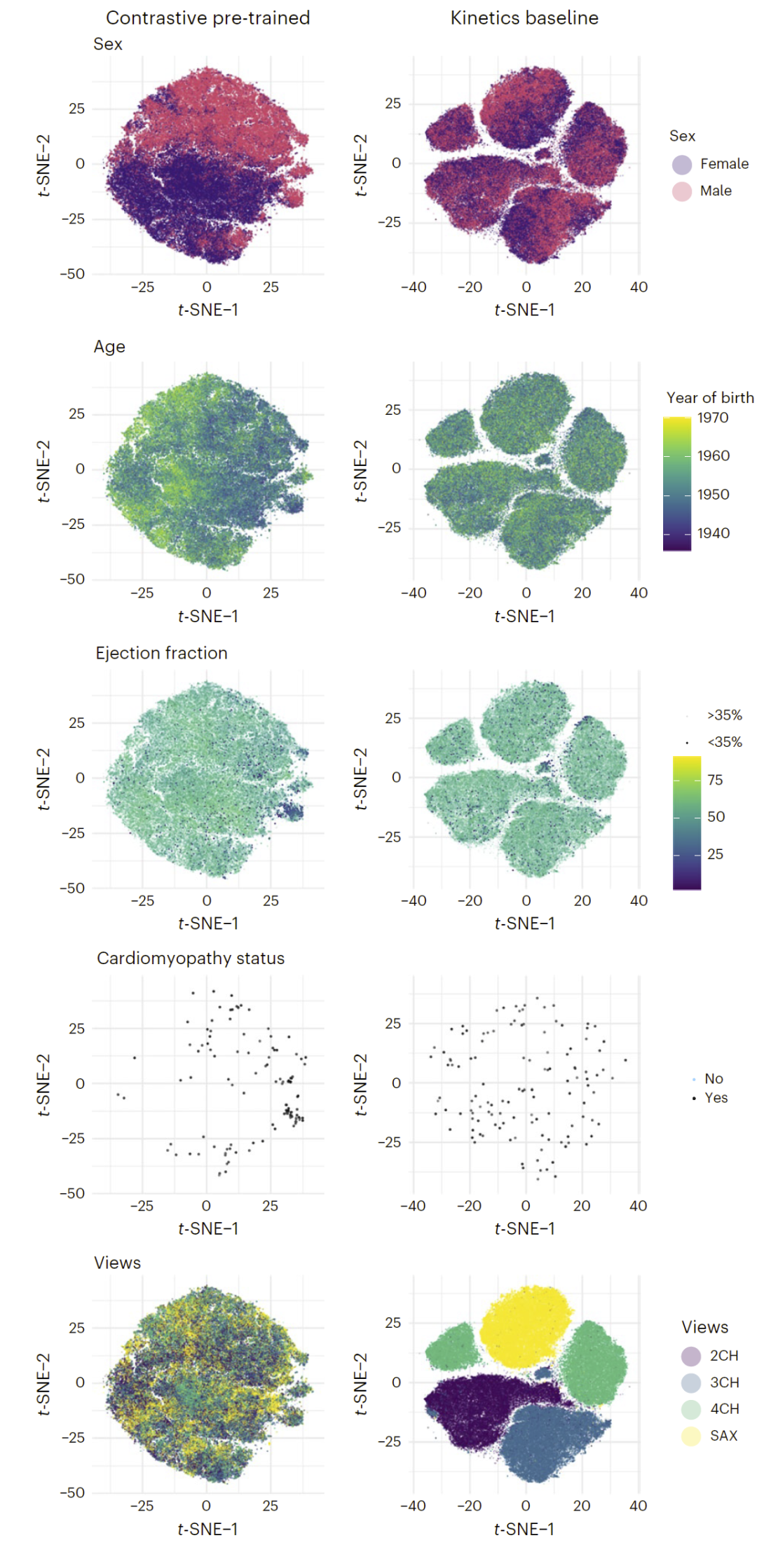 图2: 对比学习预训练使模型能够学习人口学特征和病理生理学表示。